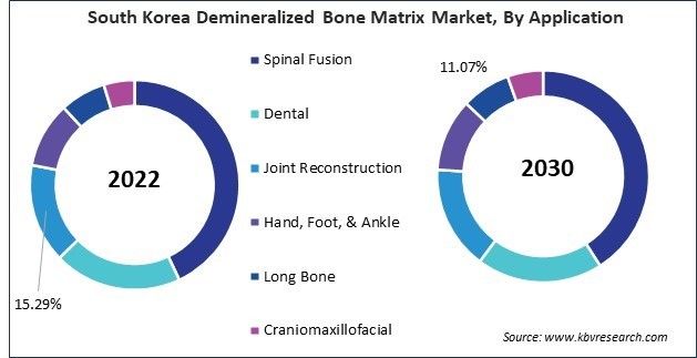 Asia Pacific Demineralized Bone Matrix Market
