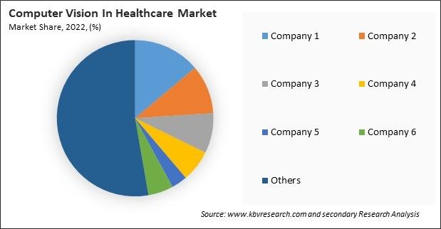 Computer Vision In Healthcare Market Share 2022